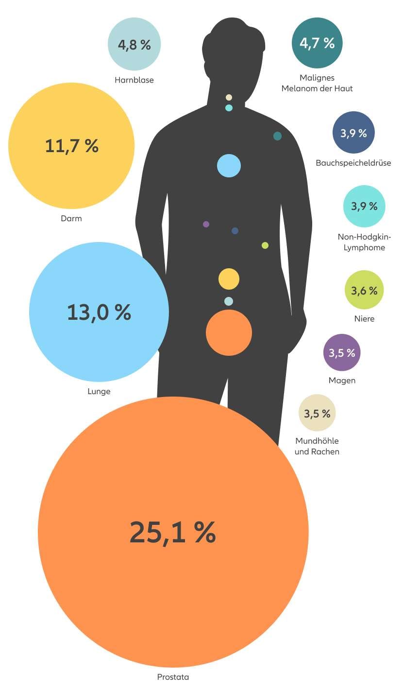Die Infografik zeigt eine stilisierte Männerfigur mit farbigen Kreisen an unterschiedlichen Körperstellen, die die häufigsten Krebsneuerkrankungen bei Männern in Deutschland im Jahr 2020 und deren prozentualen Anteil darstellen. Prostata: 25,1 % (größter orangefarbener Kreis im Beckenbereich) Lunge: 13,0 % (großer hellblauer Kreis im unteren Brustbereich) Darm: 11,7 % (großer gelber Kreis im Bauchraum) Harnblase: 4,8 % (türkisfarbener Kreis oberhalb der Hüfte) Malignes Melanom der Haut: 4,7 % (blaugrüner Kreis am rechten Oberarm) Bauchspeicheldrüse: 3,9 % (dunkelblauer Kreis im mittleren Bauchraum) Non-Hodgkin-Lymphome: 3,9 % (türkiser Kreis auf dem rechten Oberkörper) Niere: 3,6 % (hellgrüner Kreis seitlich am unteren Rücken) Magen: 3,5 % (lilafarbener Kreis im mittleren Bauchraum) Mundhöhle und Rachen: 3,5 % (hellbeiger Kreis im Halsbereich) Die Prozentzahlen zeigen den Anteil dieser Krebsarten an allen Krebsneuerkrankungen bei Männern im genannten Jahr.