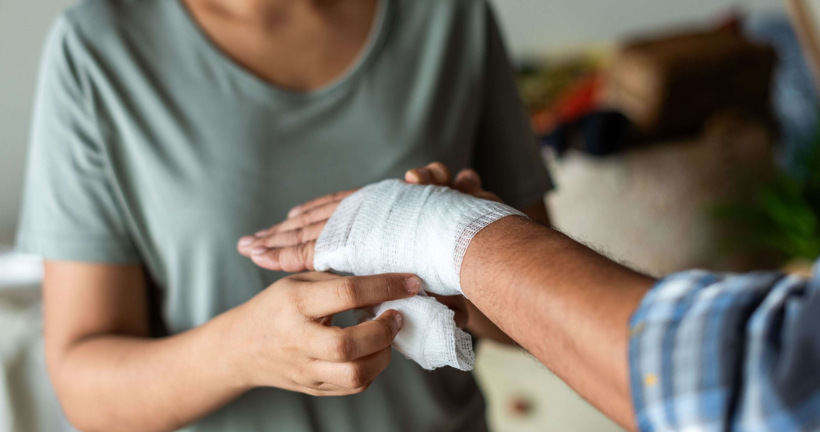Allianz Gesundheitswelt - Verbrennungen: eine Hand wird von einer medizinischen fachkraft mit einer Mullbinde verbunden, um die Verbrennungen vor äußeren Einflüssen zu schützen.